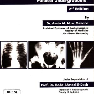 Simplified Radiodiagnosis for Medical Undergraduate 2nd Edition